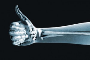 В Арзамасе открыли безвредный рентген