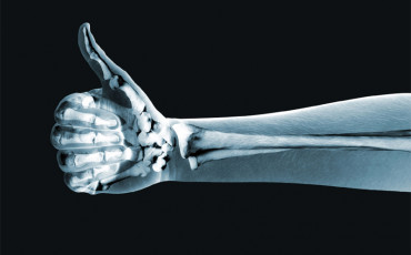 В Арзамасе открыли безвредный рентген